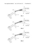 ARCHERY BOW LIMB DAMPENING SYSTEM diagram and image