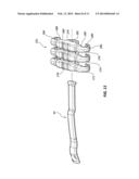 ARCHERY BOW LIMB DAMPENING SYSTEM diagram and image