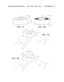 DEVICES FOR CONTAINING FLUID AND DEBRIS ON ENDOTRACHEAL TUBES, LARYNGEAL     MASKS, ENDOSCOPES, BRONCHOSCOPES AND CATHETERS AND METHOD OF USE THEREOF diagram and image