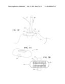 DEVICES FOR CONTAINING FLUID AND DEBRIS ON ENDOTRACHEAL TUBES, LARYNGEAL     MASKS, ENDOSCOPES, BRONCHOSCOPES AND CATHETERS AND METHOD OF USE THEREOF diagram and image