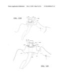 DEVICES FOR CONTAINING FLUID AND DEBRIS ON ENDOTRACHEAL TUBES, LARYNGEAL     MASKS, ENDOSCOPES, BRONCHOSCOPES AND CATHETERS AND METHOD OF USE THEREOF diagram and image