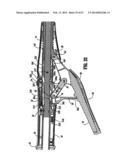 SURGICAL STAPLING DEVICE diagram and image