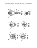 SURGICAL STAPLING DEVICE diagram and image