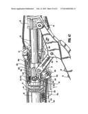 SURGICAL STAPLING DEVICE diagram and image