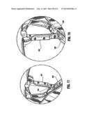 SURGICAL STAPLING DEVICE diagram and image