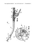 SURGICAL STAPLING DEVICE diagram and image