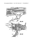 SURGICAL STAPLING DEVICE diagram and image