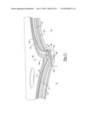 METAL GASKET WITH COATING TOPOGRAPHY diagram and image