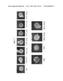 METHODS AND COMPOSITIONS FOR PREVENTING OR TREATING OPHTHALMIC CONDITIONS diagram and image