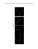 METHODS AND COMPOSITIONS FOR PREVENTING OR TREATING OPHTHALMIC CONDITIONS diagram and image