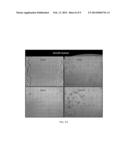 PROCOLLAGEN CARBOXY-TERMINAL PROPEPTIDES AS A TARGET AND TREATMENT FOR     ANGIOGENESIS RELATED DISEASES diagram and image