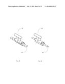 Orthodontic device diagram and image