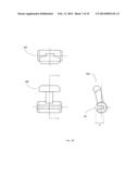 Orthodontic device diagram and image