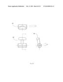 Orthodontic device diagram and image