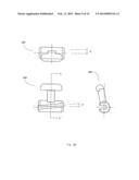 Orthodontic device diagram and image