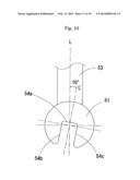 Orthodontic device diagram and image