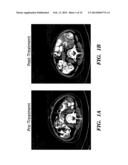 METHODS FOR TREATING VIRAL DISORDERS diagram and image