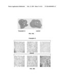 Methods and Compositions for the Treatment of Cancer and Related     Hyperproliferative Disorders diagram and image