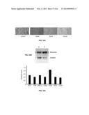 Methods and Compositions for the Treatment of Cancer and Related     Hyperproliferative Disorders diagram and image