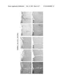 LAQUINIMOD FOR TREATMENT OF CANNABINOID RECEPTOR TYPE 1(CB1) MEDIATED     DISORDERS diagram and image