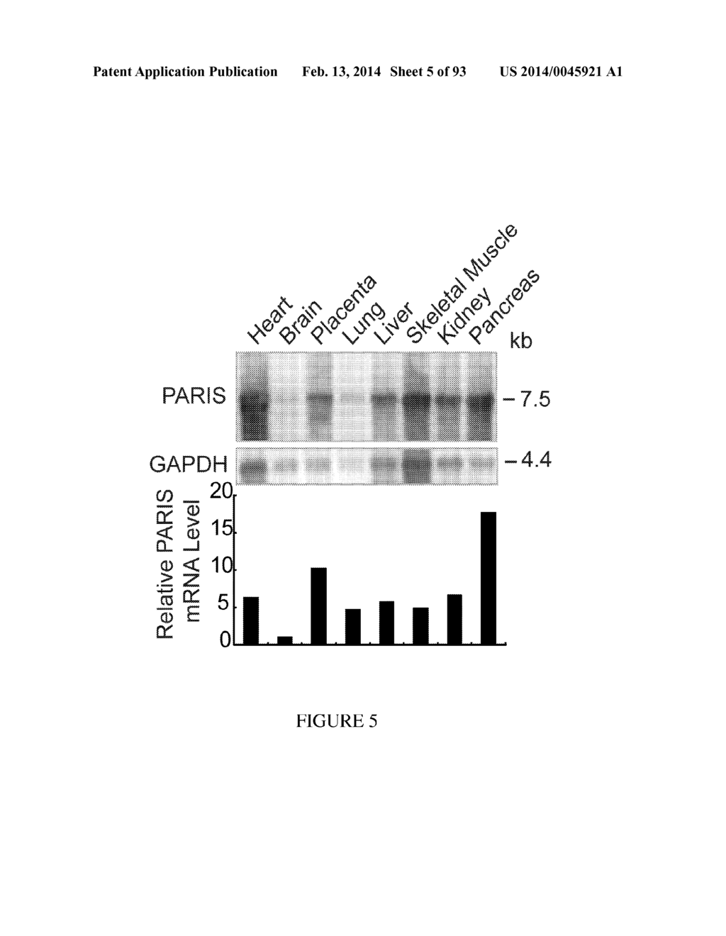 TRANSCRIPTIONAL REPRESSION LEADING TO PARKINSON'S DISEASE - diagram, schematic, and image 06