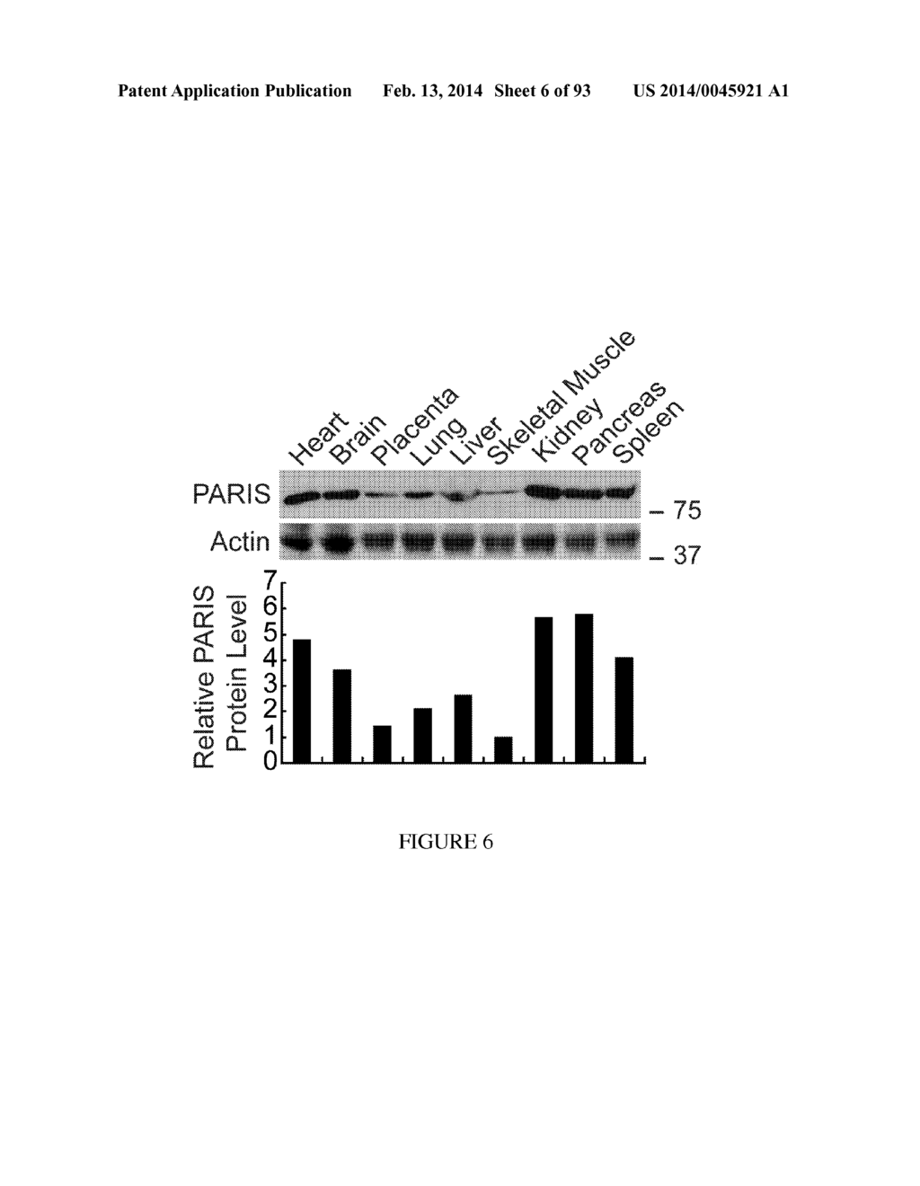 TRANSCRIPTIONAL REPRESSION LEADING TO PARKINSON'S DISEASE - diagram, schematic, and image 07