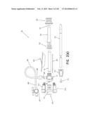 METHODS AND SYSTEMS FOR PERFORMING A MEDICAL PROCEDURE diagram and image