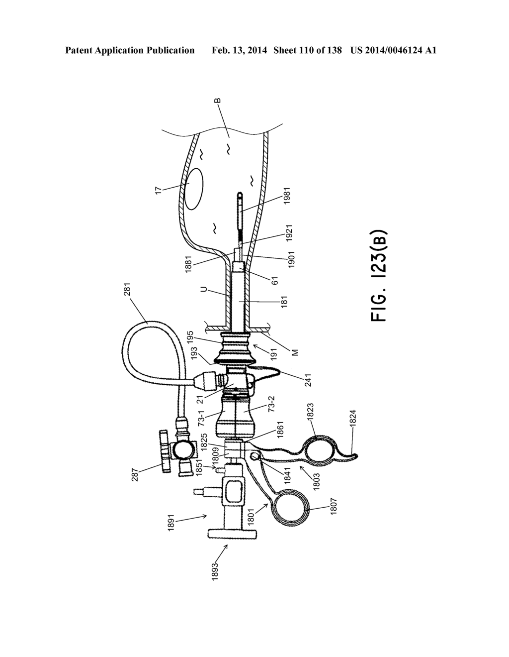 METHODS AND SYSTEMS FOR PERFORMING A MEDICAL PROCEDURE - diagram, schematic, and image 111