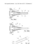 METHODS AND SYSTEMS FOR PERFORMING A MEDICAL PROCEDURE diagram and image