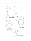 METHODS AND SYSTEMS FOR PERFORMING A MEDICAL PROCEDURE diagram and image