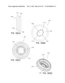 METHODS AND SYSTEMS FOR PERFORMING A MEDICAL PROCEDURE diagram and image