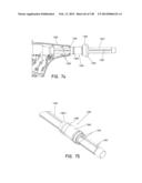 METHODS AND SYSTEMS FOR PERFORMING A MEDICAL PROCEDURE diagram and image