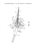 METHODS AND SYSTEMS FOR PERFORMING A MEDICAL PROCEDURE diagram and image