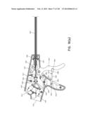 METHODS AND SYSTEMS FOR PERFORMING A MEDICAL PROCEDURE diagram and image