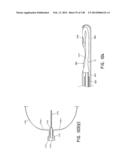 METHODS AND SYSTEMS FOR PERFORMING A MEDICAL PROCEDURE diagram and image