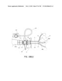 METHODS AND SYSTEMS FOR PERFORMING A MEDICAL PROCEDURE diagram and image