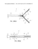 METHODS AND SYSTEMS FOR PERFORMING A MEDICAL PROCEDURE diagram and image