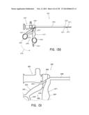 METHODS AND SYSTEMS FOR PERFORMING A MEDICAL PROCEDURE diagram and image