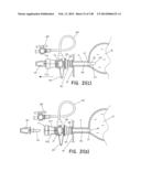 METHODS AND SYSTEMS FOR PERFORMING A MEDICAL PROCEDURE diagram and image