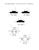 METHODS AND SYSTEMS FOR PERFORMING A MEDICAL PROCEDURE diagram and image