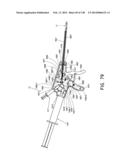 METHODS AND SYSTEMS FOR PERFORMING A MEDICAL PROCEDURE diagram and image