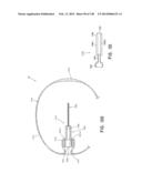 METHODS AND SYSTEMS FOR PERFORMING A MEDICAL PROCEDURE diagram and image