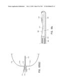 METHODS AND SYSTEMS FOR PERFORMING A MEDICAL PROCEDURE diagram and image