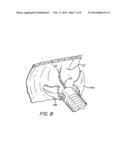 Surgical Method Utilizing Transluminal Endoscope and Instruments diagram and image