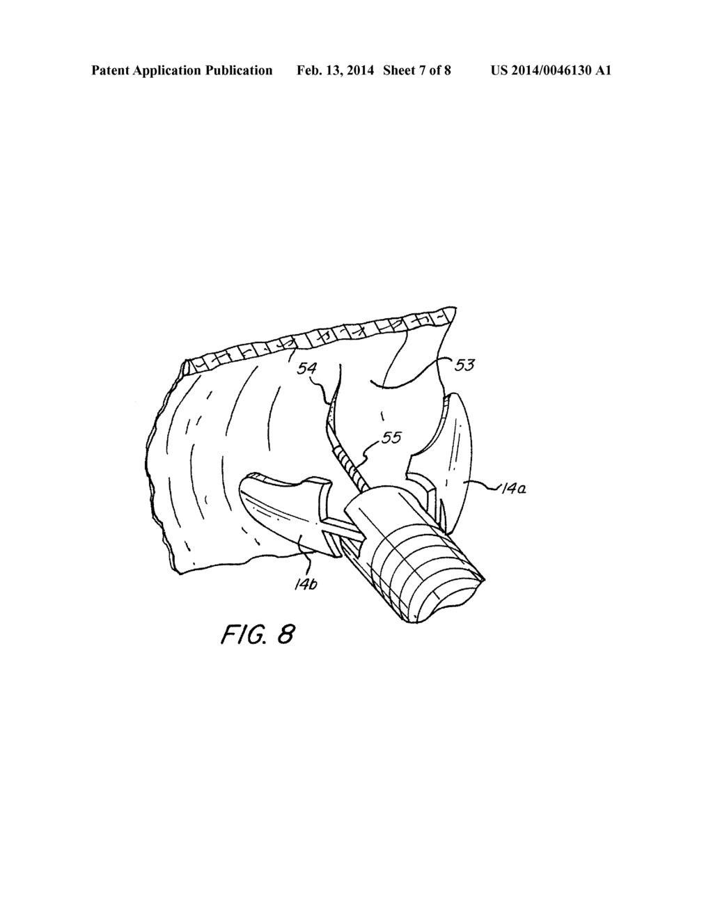 Surgical Method Utilizing Transluminal Endoscope and Instruments - diagram, schematic, and image 08