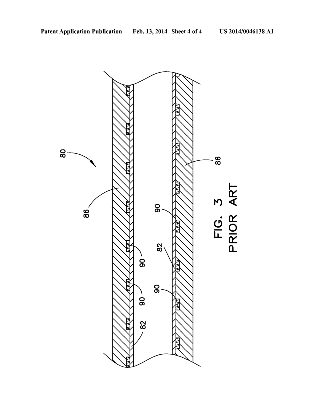 INTRODUCER SHEATH HAVING PROFILED REINFORCING MEMBER - diagram, schematic, and image 05