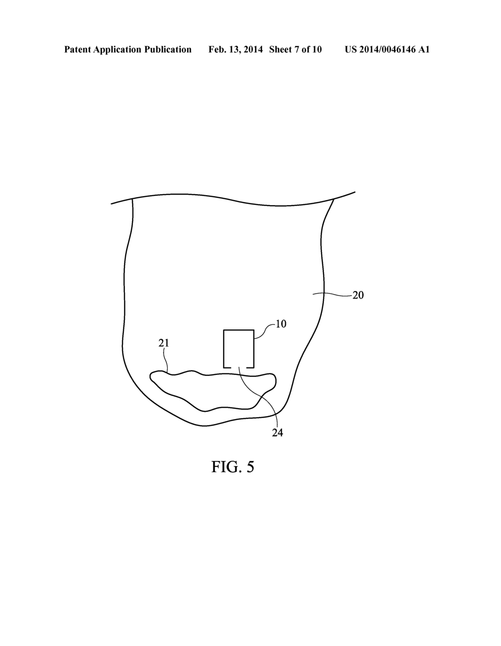 ANALYSIS & CLEARING MODULE, SYSTEM AND METHOD - diagram, schematic, and image 08