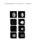 BRAIN VOLUMETRIC MEASURING METHOD AND SYSTEM USING THE SAME diagram and image