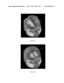 BRAIN VOLUMETRIC MEASURING METHOD AND SYSTEM USING THE SAME diagram and image