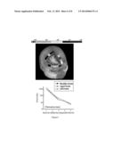 BRAIN VOLUMETRIC MEASURING METHOD AND SYSTEM USING THE SAME diagram and image